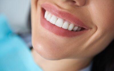 When Should You Get a Dental Crown?