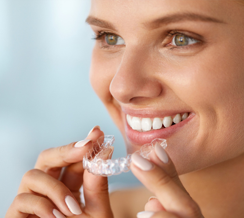 lnvisalign in london